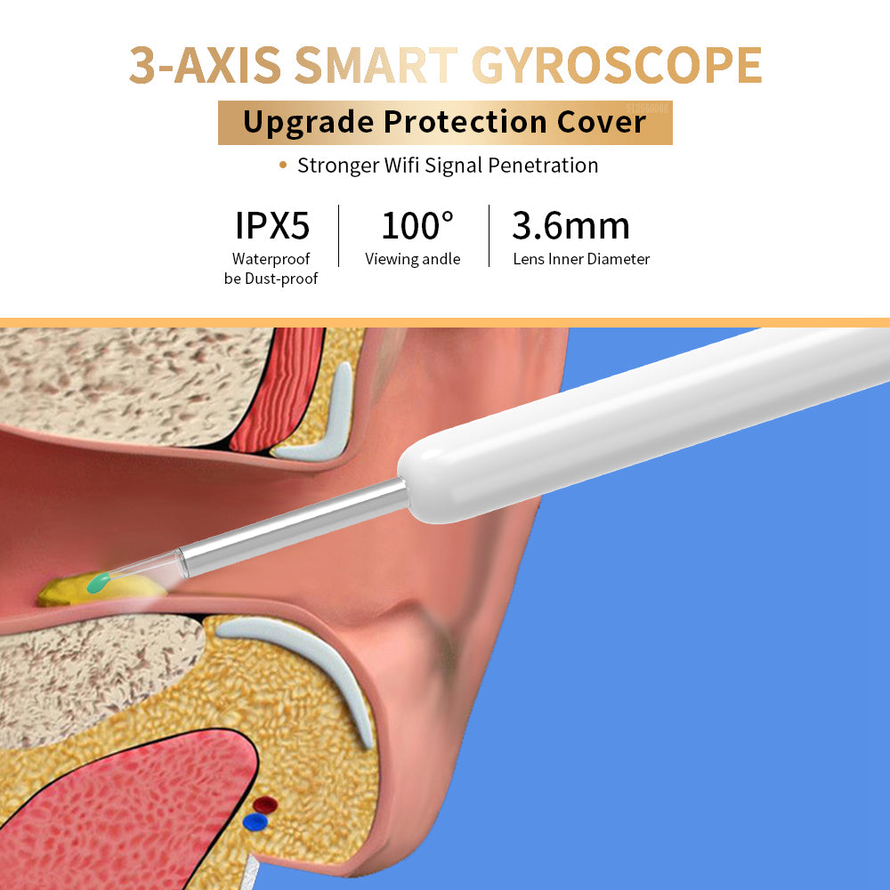 NE3 Wireless Otoscope