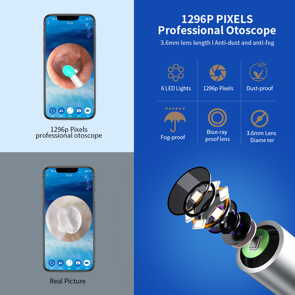 NE3 Wireless Otoscope